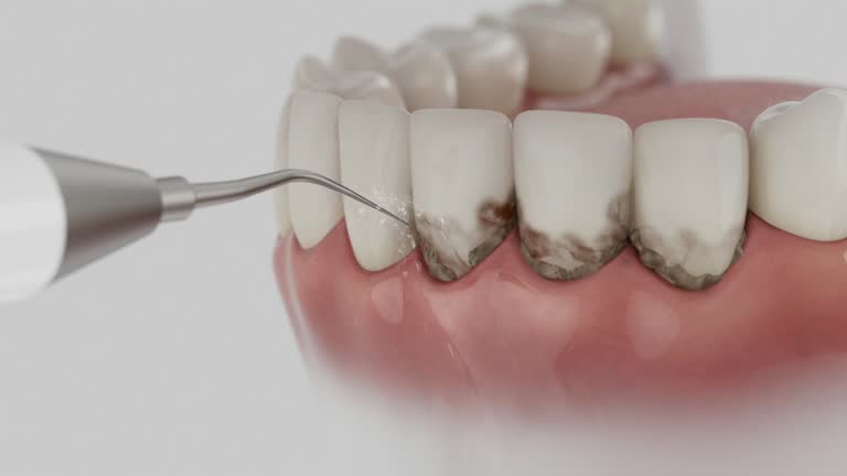 Reliable Dental contractor in Caledonia County County, VT by Dentist Open Now